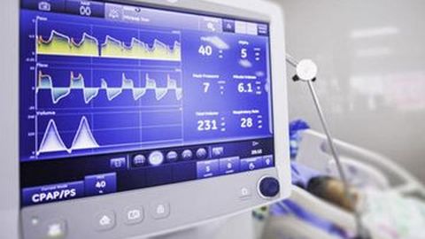 Pabrikan Otomotif di Indonesia Bersiap Bikin Ventilator bagi Pasien Corona